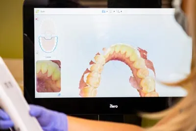 X-ray taken of a patient's teeth at Edgewater Dental Arts
